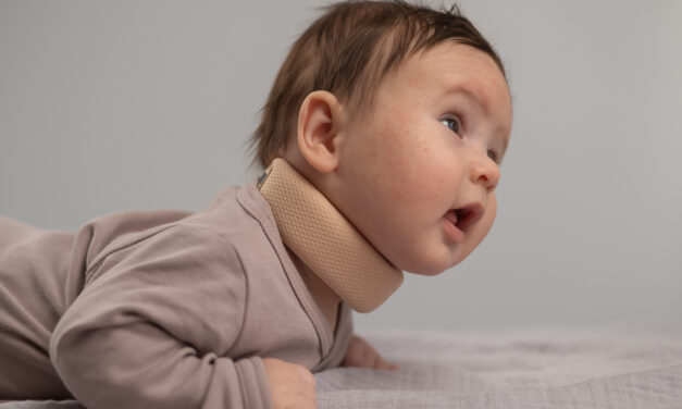 A parent’s guide to pediatric torticollis treatment